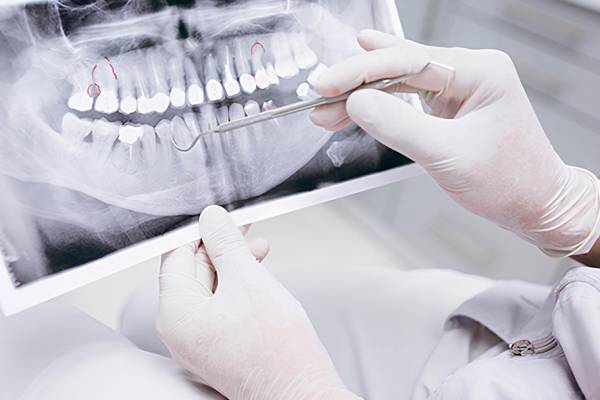 Рентгенодиагностика